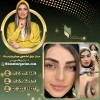 میکروبلیدینگ ابرو با روش های تضمینی