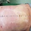 قیمت پروتز سینه
