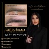 بهترین مرکز ریموو ابرو در تهران 09127367972