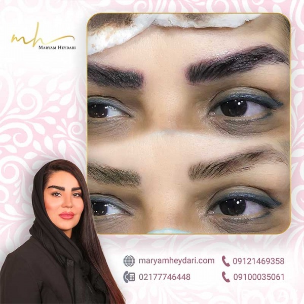 پاک کردن میکروبلیدینگ ابرو با روش های تضمینی