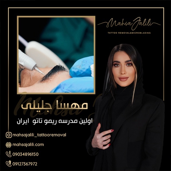 ریمو تاتو بدون لیزر و درد