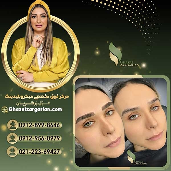 هاشور کرکی با بیشترین کیفیت