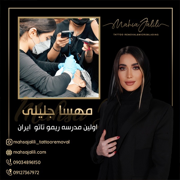 آموزش ریموو تاتو بدن از صفر تا صد و اصولی