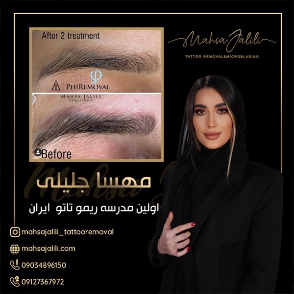 بهترین مرکز ریموو ابرو در تهران 09127367972