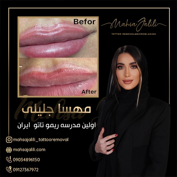 آموزش ریمو تاتو خط لب به صورت کاربردی