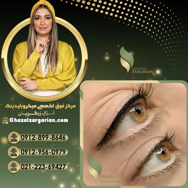 خط چشم دائم با روش های اصولی و شناخته شده