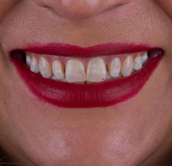 خدمات کامپوزیت در شریعتی