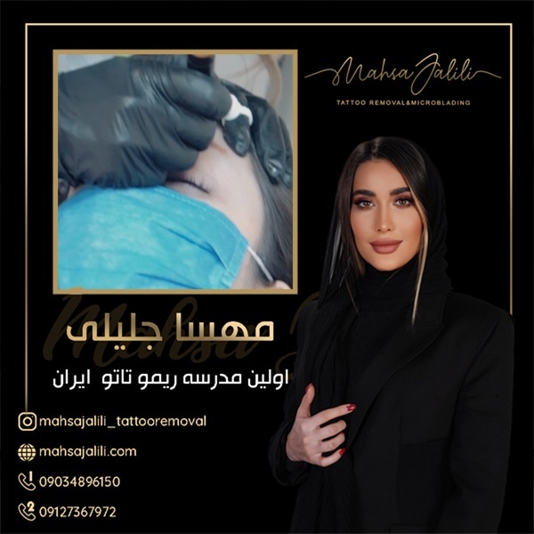 ریمو تاتو بدن بدون لیزر