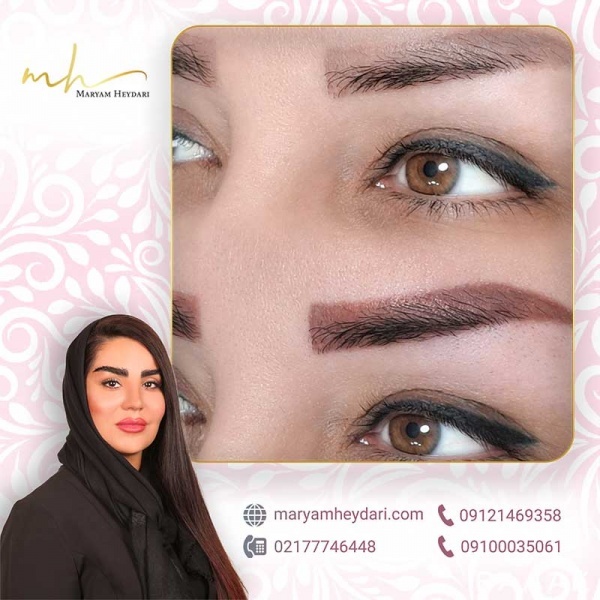 ریموو تاتو ابرو با تکنیک های جدید