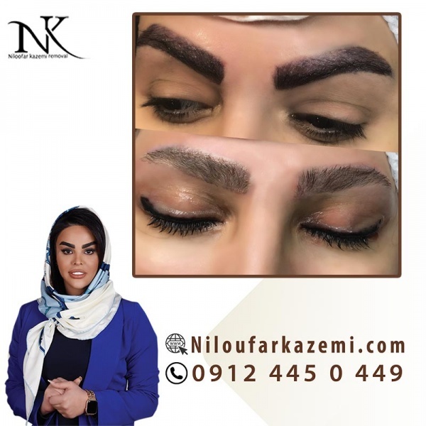 آموزش ریموو تاتو ابرو به صورت تخصصی