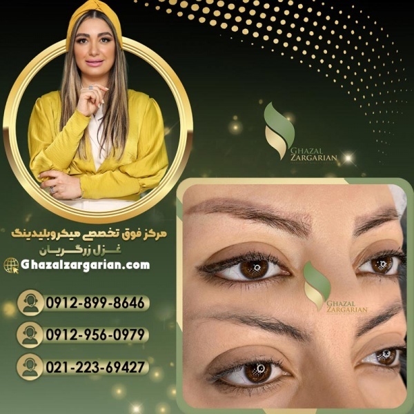 ریموو ابرو بصورت حرفه ای