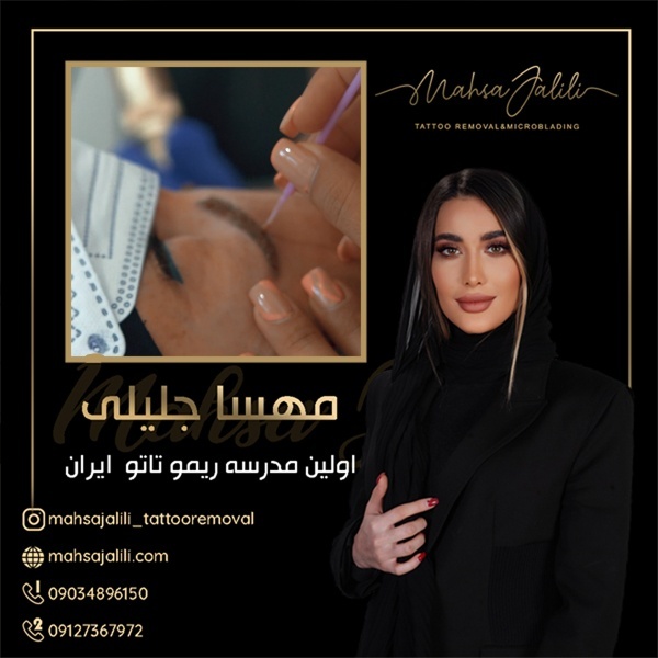 ریموو تاتو بدن با بهترین کیفیت و تضمینی