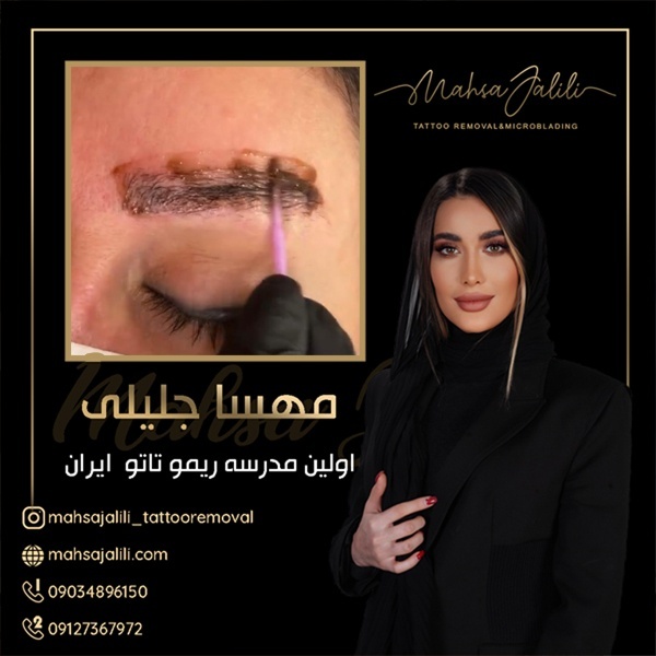 آموزش ریموو تاتو با بروزترین تکنیک ها استاد جلیلی